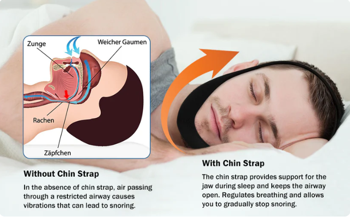 đ„Last Day SALE 50% OFFđ„AirFlow Jaw Strap