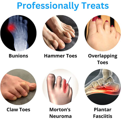 FlexiToes - Natural Toe Aligners